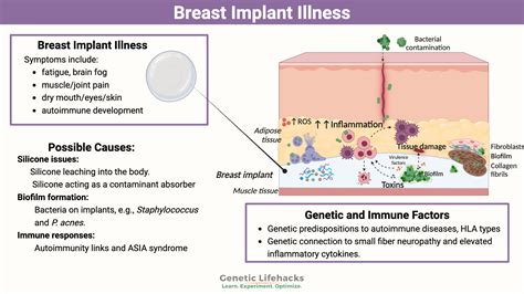 Breast Implant Illness: The Interplay of Genetics and Symptoms
