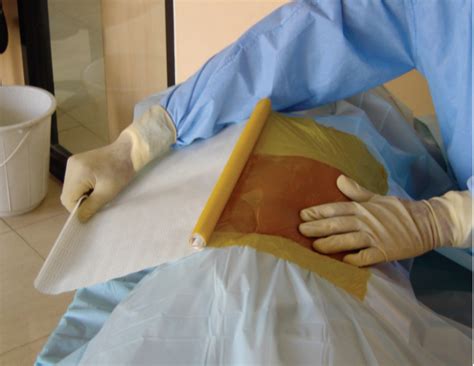 Ortholink Io- Drape Mini -Size 15x10 cm, adhesive 10x10cm | Marks ...