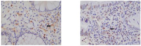 Diagnostics | Special Issue : IBD: New Trends in Diagnosis and Management