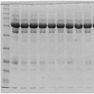 Image result for Capd Flow Sheet