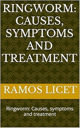 Ringworm: Causes, symptoms and treatment: Ringworm: Causes, symptoms ...