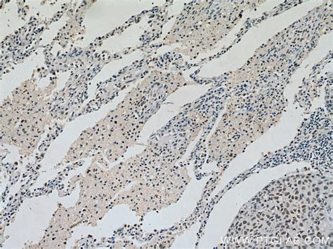 KDM1 antibody (67037-1-Ig) | Proteintech