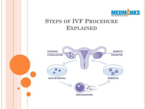 IVF Procedure Explained 的图像结果