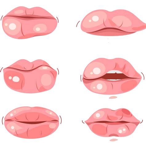 Red Bump On Lip Line No Pain - Infoupdate.org