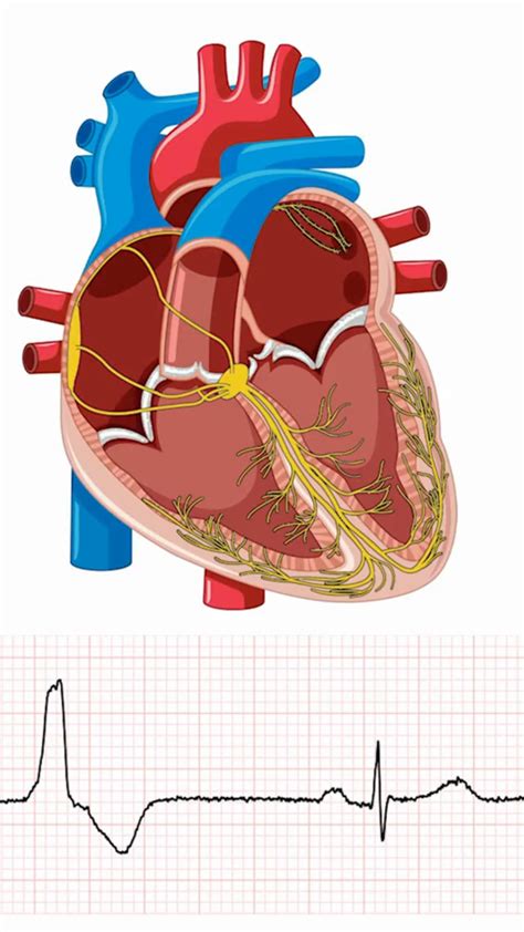 Premature ventricular contractions premature junctional contractions ...