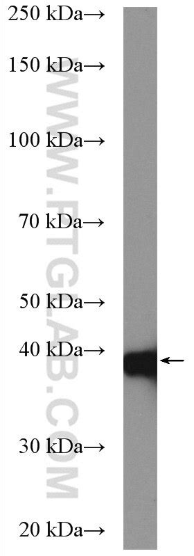 TBCC antibody (15917-1-AP) | Proteintech