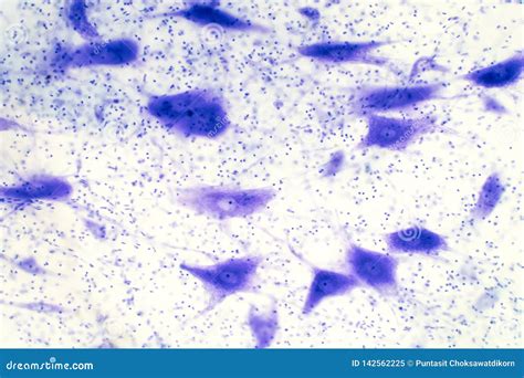 Image result for Brain Under Microscope