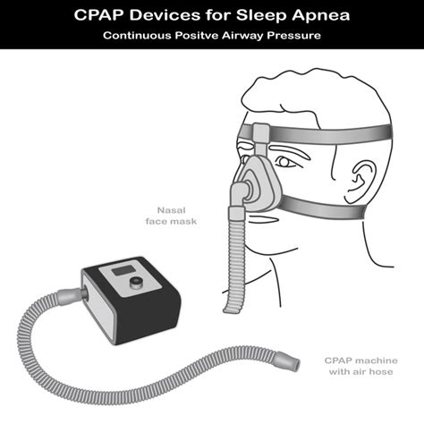 Image result for CPAP and BiPAP Machine Drawing