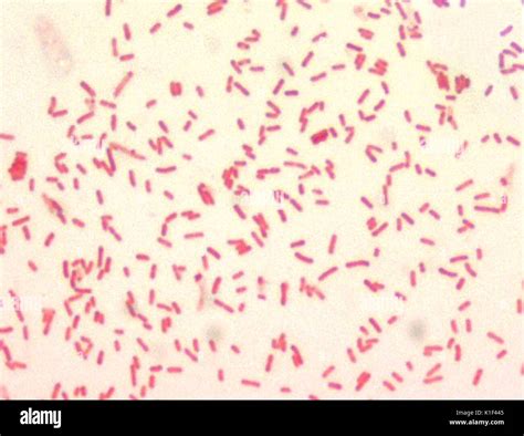 Yersinia Pestis Treatment
