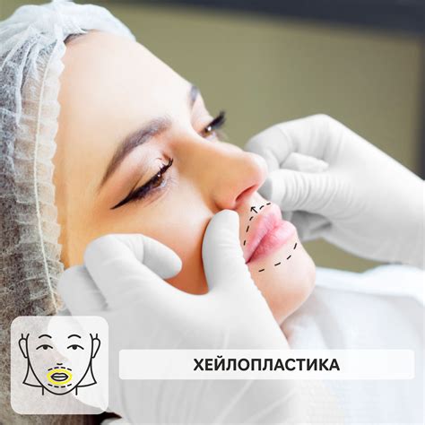 Хейлопластика - пластика губ в Москве быстро и безболезненно - Новая ...