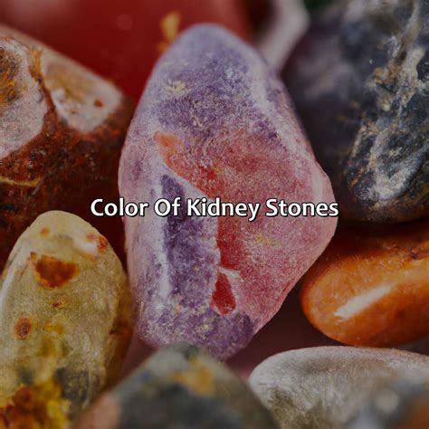 What Color Is A Kidney Stone - colorscombo.com