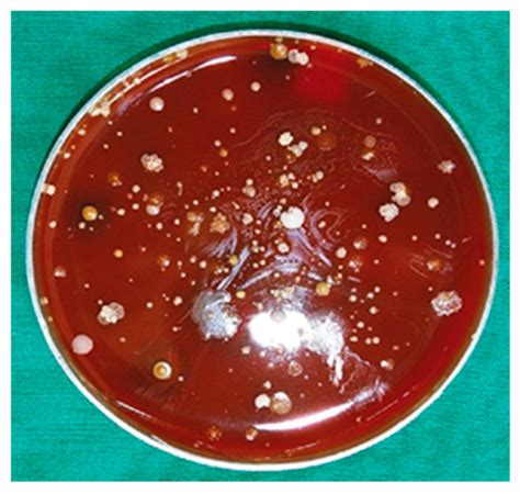 Actinobaculum massiliense Proteome Profiled in Polymicrobial Urethral ...