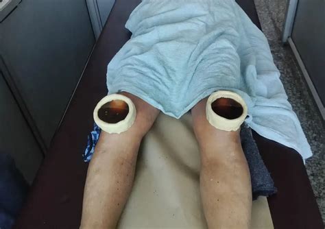 Best Panchkarma & Ayurvedic Treatments Near You | Affordable Care