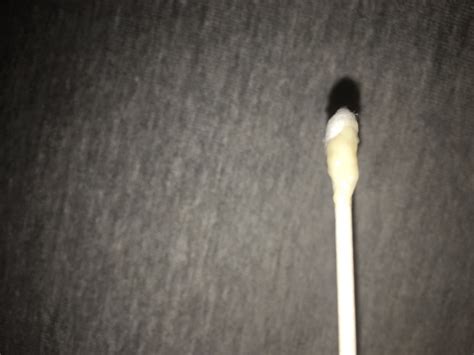 Clumpy Discharge 的图像结果