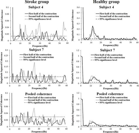 Image result for Muscle Activity EMG