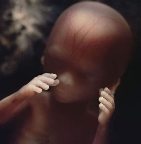 子宫内胎儿发育震撼照：10周大胎儿眼睑半闭(2)_科学探索_科技时代_新浪网