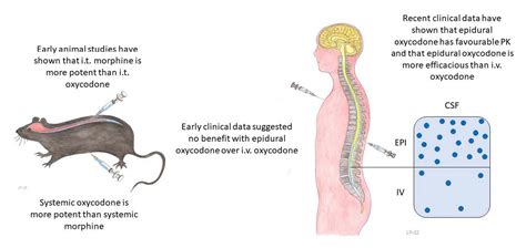 Epidural Oxycodone for Acute Pain