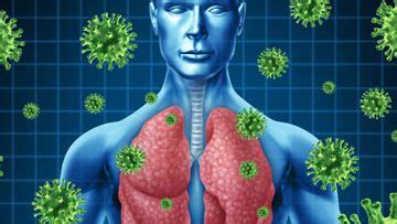 Pediatric Radiology : Pulmonary Infections - Radiology : Pulmonary ...