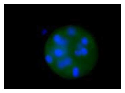 Image result for LPL LPAR