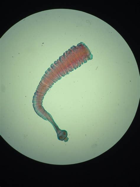Taenia solium sp. under L.P.O Cutie! Haha | Medical laboratory science, Microbiology, Medical ...