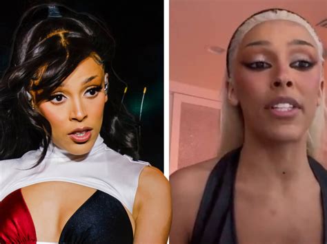 Doja Cat Plastic Surgery: Art, Identity & Transformation