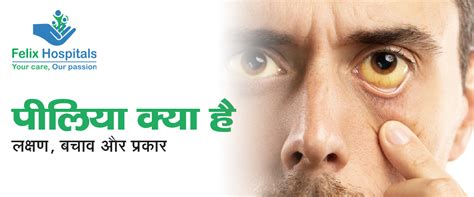 पीलिया क्या है (Jaundice in Hindi) लक्षण , बचाव और प्रकार