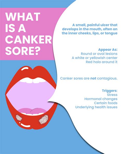 Do you know what a canker sore is? | Excel Urgent Care of NY & NJ