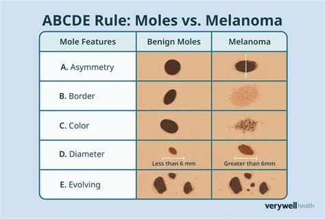 Types of Cancer Names 的图像结果