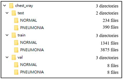 An Improved VGG16 Model for Pneumonia Image Classification