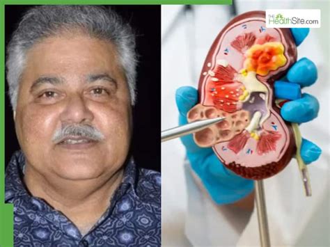 Satish Shah Passes Away Due To Kidney Failure: Common Complications ...