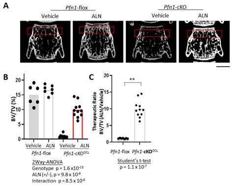 Osteolytic Bone Loss and Skeletal Deformities in a Mouse Model for ...
