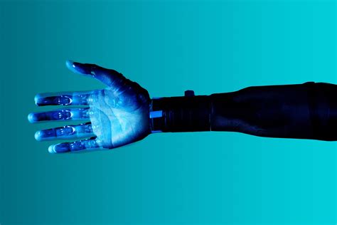 Image result for Computer Assisted Surgery