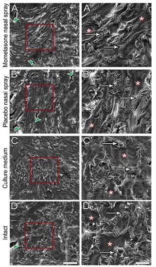 In Vitro Ciliotoxicity and Cytotoxicity Testing of Repeated Chronic ...