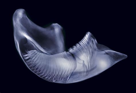 Xray Artist
