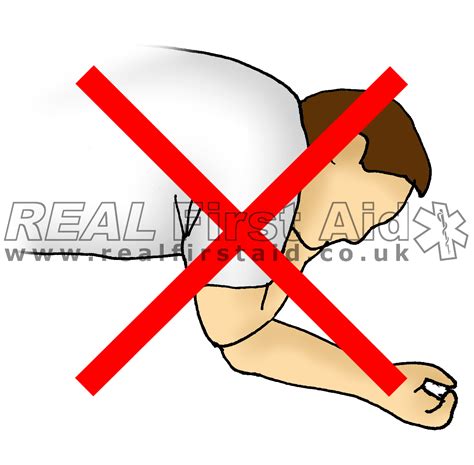 Casualty Positioning — REAL First Aid