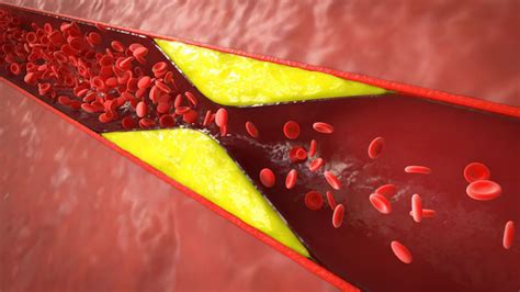 உடலில் உள்ள கெட்ட கொழுப்பை கரைத்து, நரம்புகளில் சிக்கியுள்ள கொழுப்பை ...