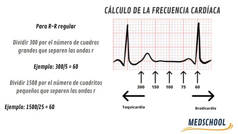 Cómo Calcular la Frecuencia Cardíaca en un Electrocardiograma: Guía para Estudiantes de Medicina