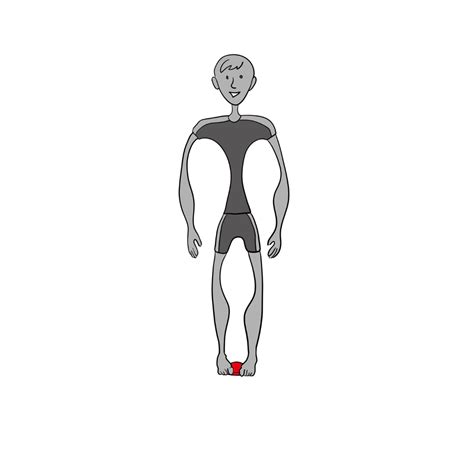 How to Correct Overpronation Using the Pelvic Clock® Exercise Device — Pelvic Clock® Exercise Device