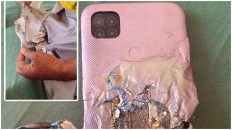 TVS Ntorq 150 Vs Hero Xoom 160 GST 2.0 Price Difference - Specification ...