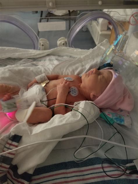 Premature Babies 32 Weeks