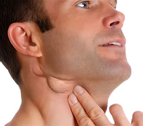 Glandular Swellings & Inflammation – ZEVIKA HEALTH