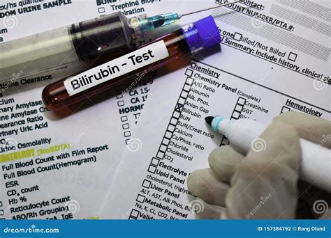 Bilirubin - Test with Blood Sample. Top View Isolated on Office Desk Stock Photo - Image of ...