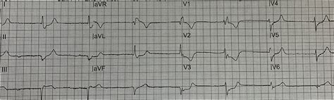 Image result for STEMI Cath Lab