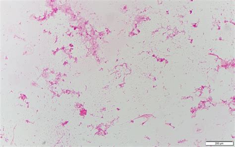Haemophilus influenzae〔インフルエンザ桿菌〕 | グラム染色: Gram Stain