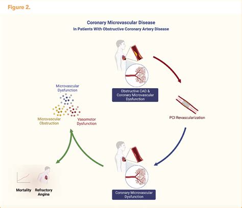 Spotlight Series | Microvascular Dysfunction: Coronary Microvascular Disease in Patients With ...