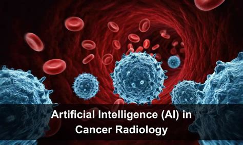 Artificial Intelligence (AI) in Cancer Radiology-Recent Cureus Review ...