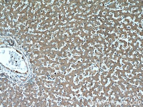 MTRF1 antibody (11581-1-AP) | Proteintech