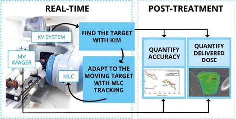 Linear Accelerator Therapy 的图像结果
