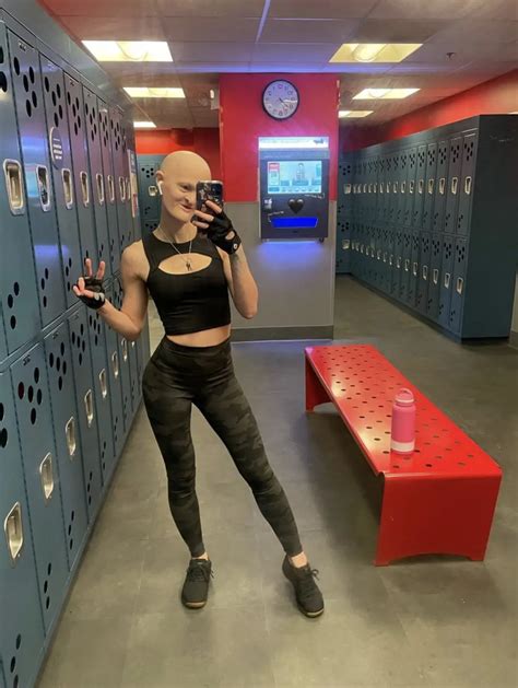 6 Potret Melanie Gaydos, Model Sukses yang Idap Kelainan Genetik