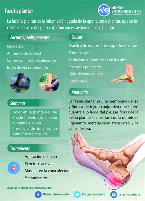 ¿Qué Es La Fasciosis Plantar? : ¿Cuál es la diferencia entre espolón y fascitis plantar? – HQZY
